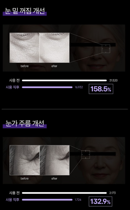 유쎄라블 아이크림 사용 후 개선효과