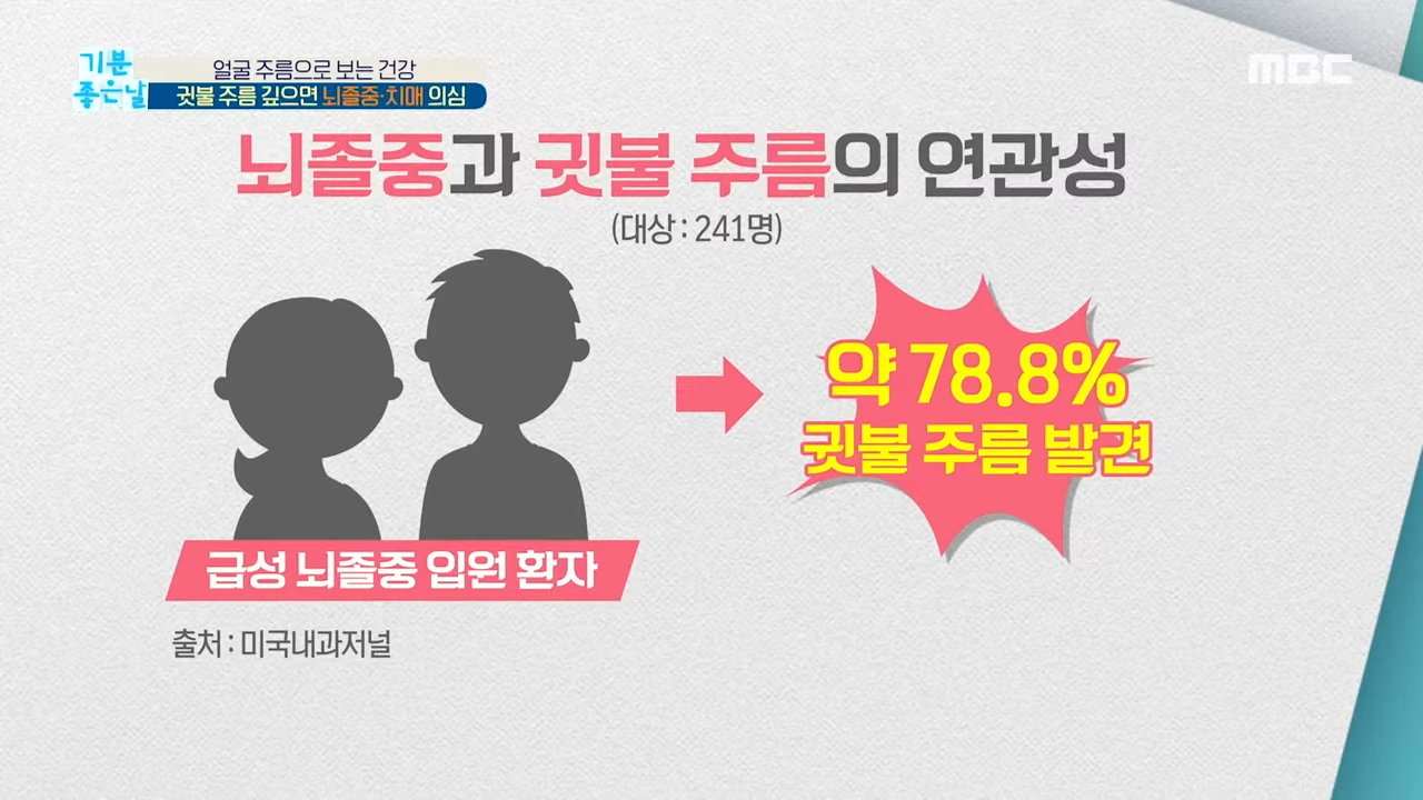 귓볼주름