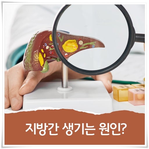 지방간이 생기는 진짜 원인