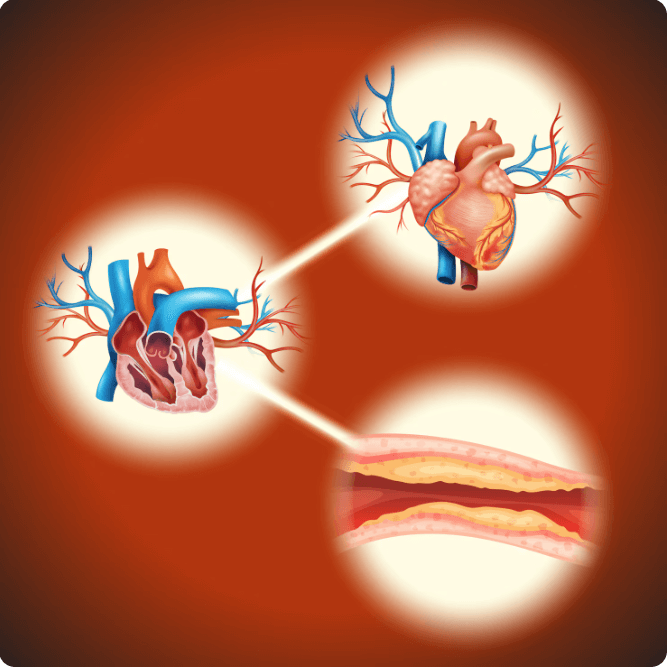심혈관 질환을 유발할 수 있는 당뇨병