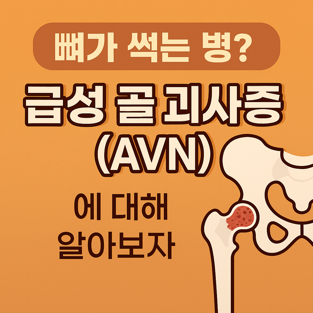 급성 골 괴사증