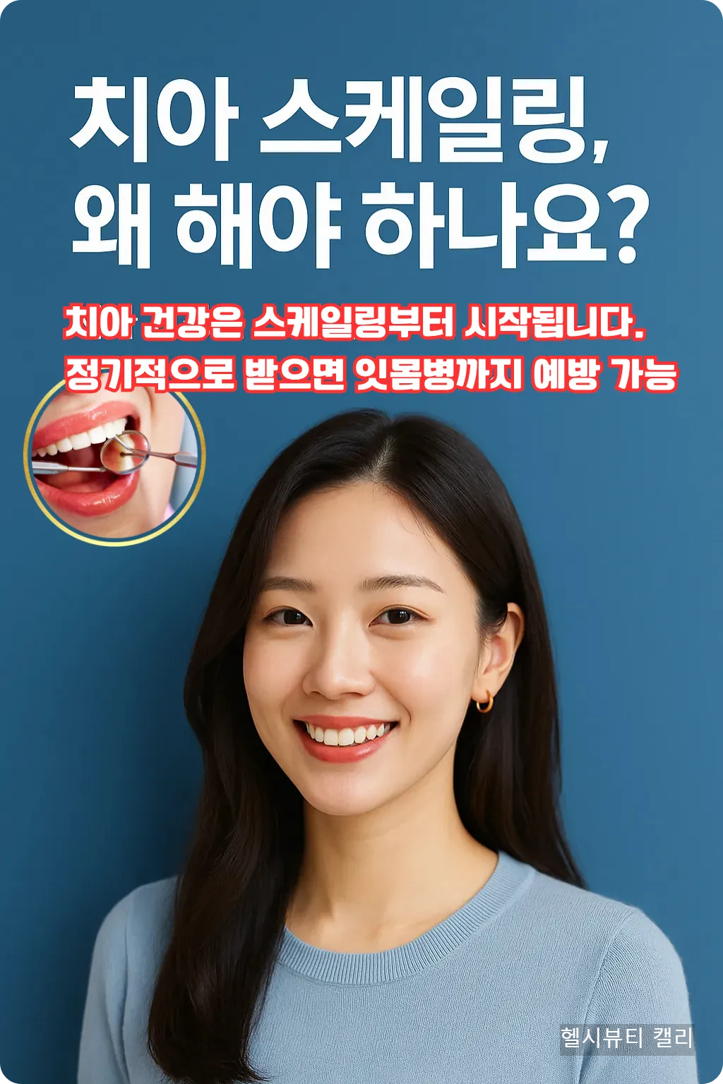 치아 스케일링, 왜 해야 하나요? 치아 건강은 스케일링부터 시작됩니다. 정기적으로 받으면 잇몸병까지 예방 가능!