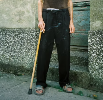 골다공증 치료방법 진단기준 예방법