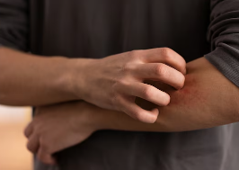 피부가려움증의 원인 28