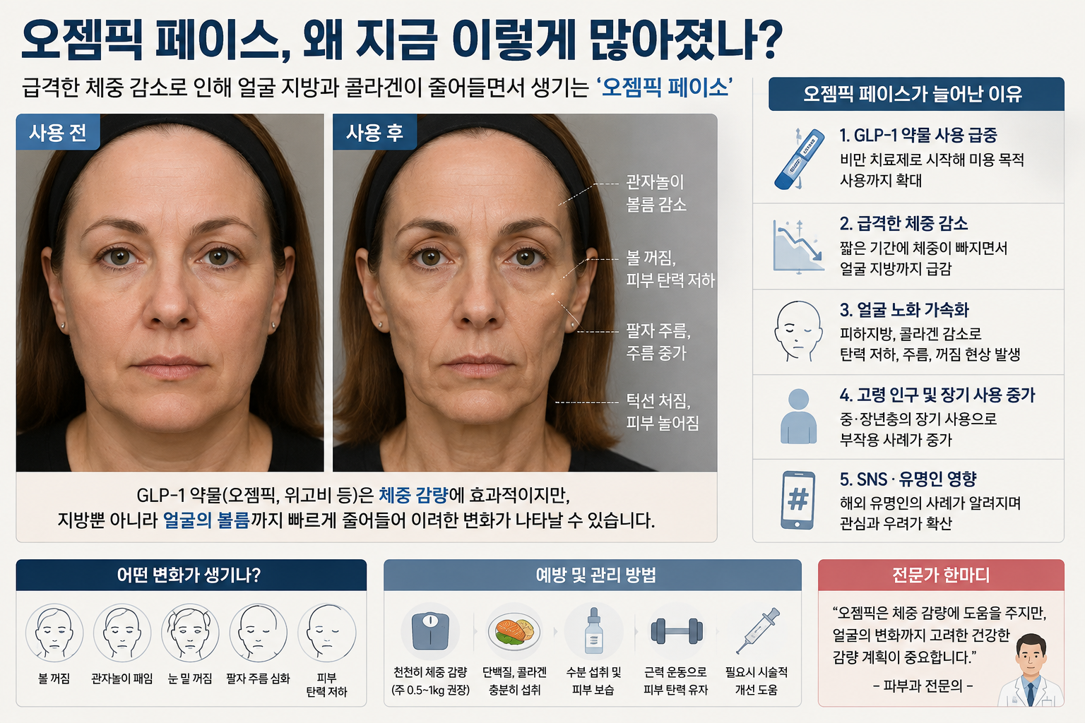 위고비&middot;마운자로 복용 오젬픽 페이스