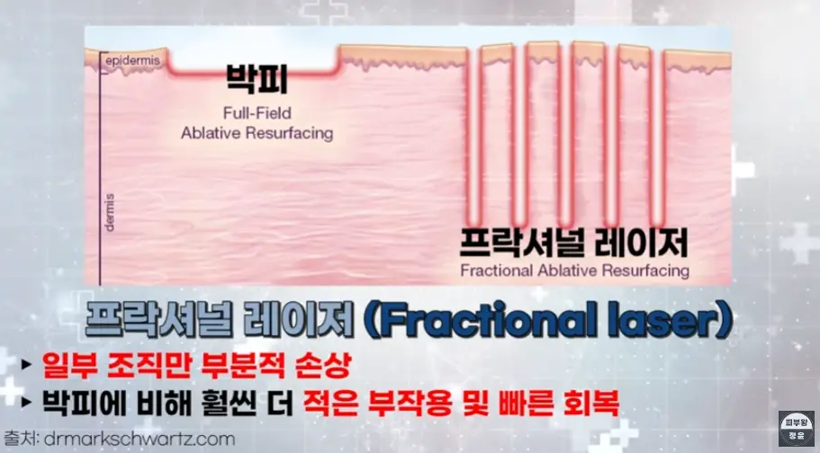 프락셀-원리