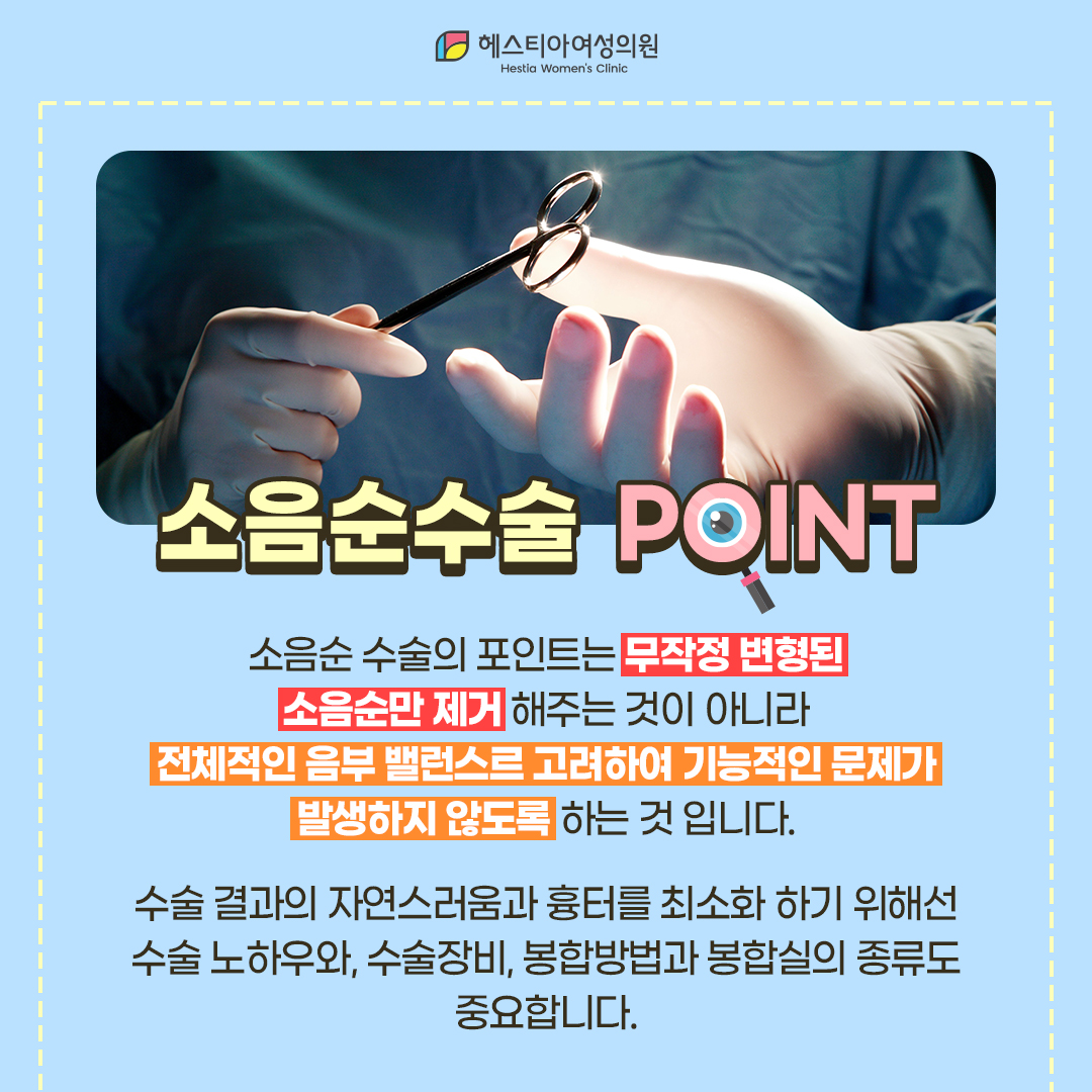 소음순수술 포인트