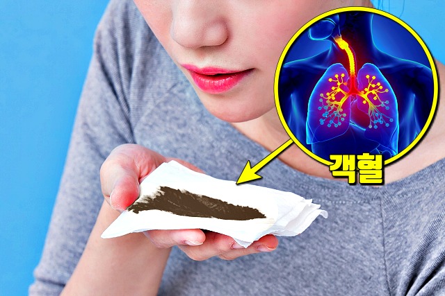 코로나 증상 객혈,우한 폐렴 증상,건강