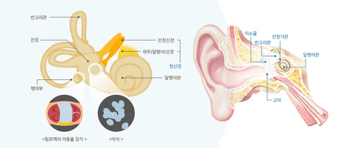 이석증 증상