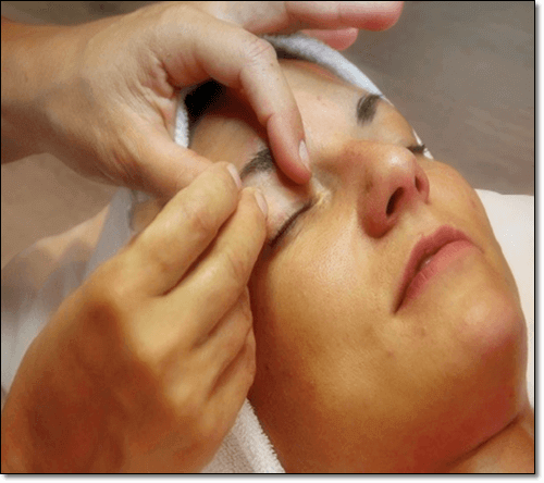 표피낭종 치료 중인 여성