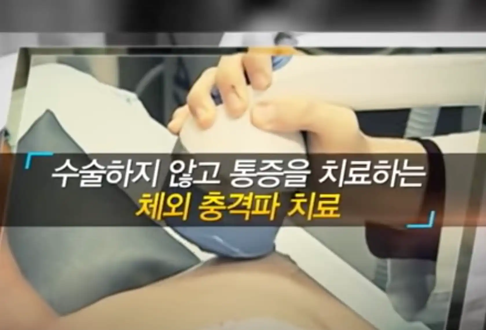 체외충격파 치료