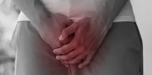 요로결석 증상 29