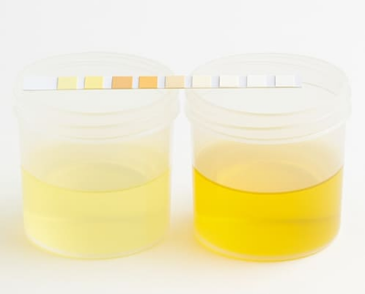 소변 색깔로 보는 건강