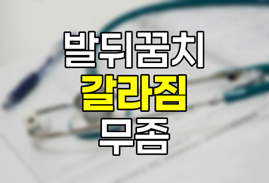 발 뒤꿈치 갈라짐 원인, 치료 및 무좀과의 차이점