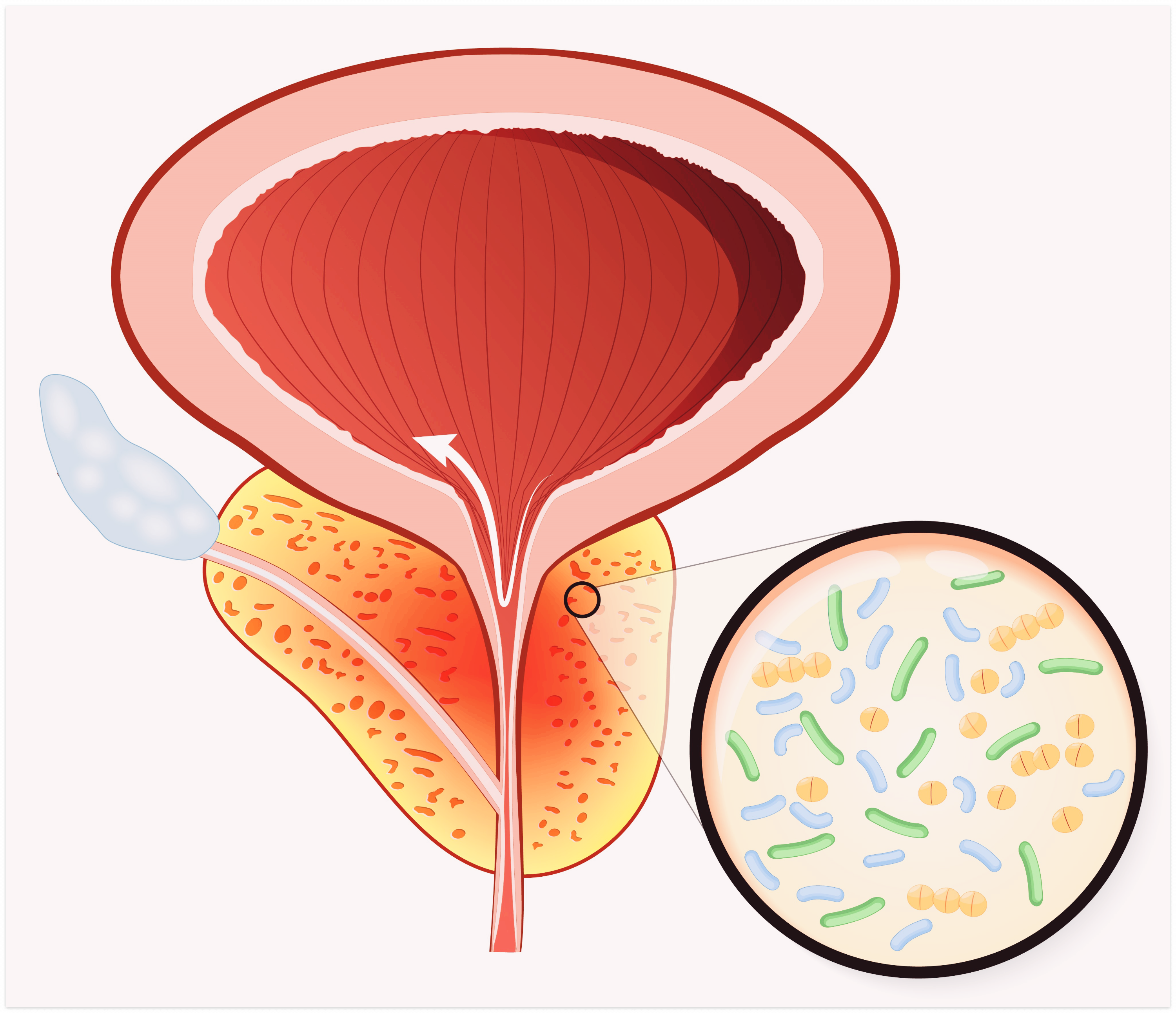 전립선에-좋은-음식