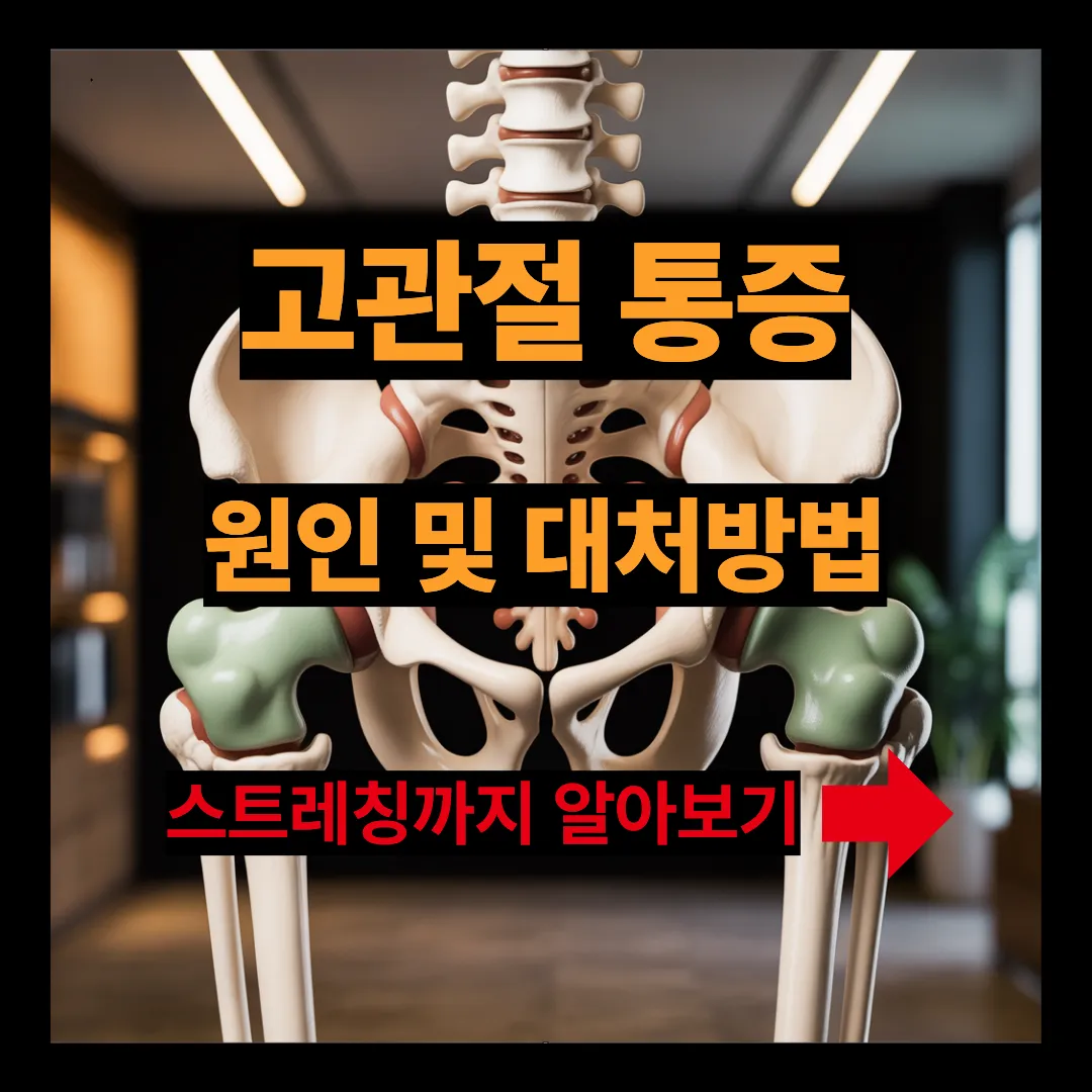 고관절 통증 원인 및 대체방법 스트레칭까지 알아보기
