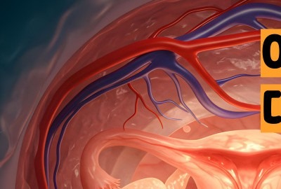 자궁경부암 증상