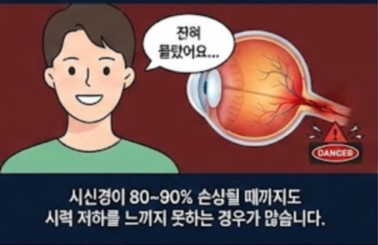 녹내장 초기증상