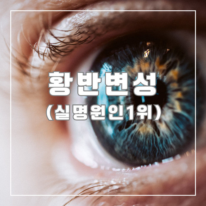 황반변성