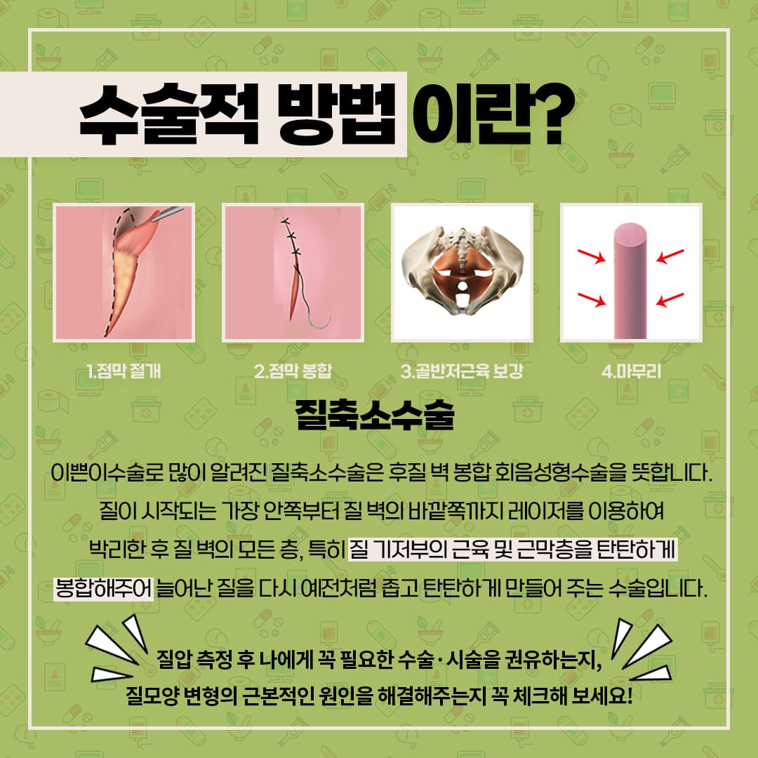 수술은 어떤건가요?