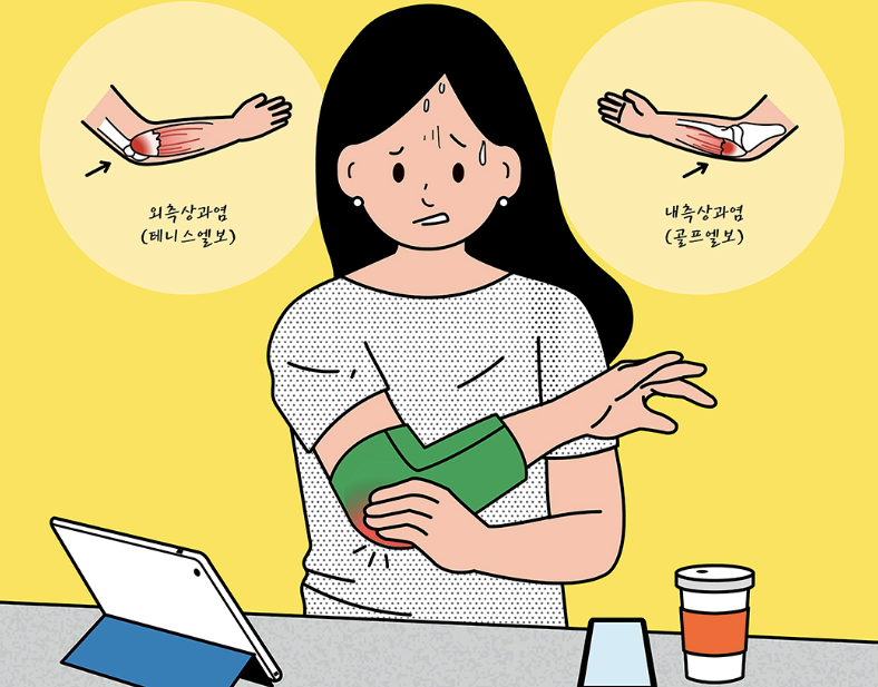 팔꿈치 통증 10가지 총정리 섬네일