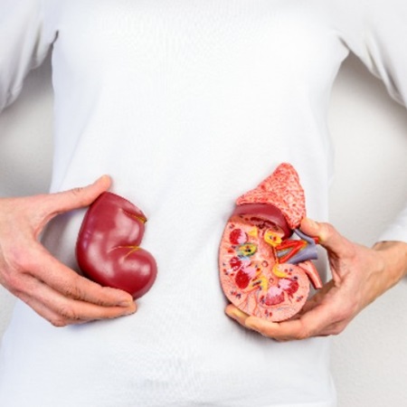 콩팥-수치가-높은경우