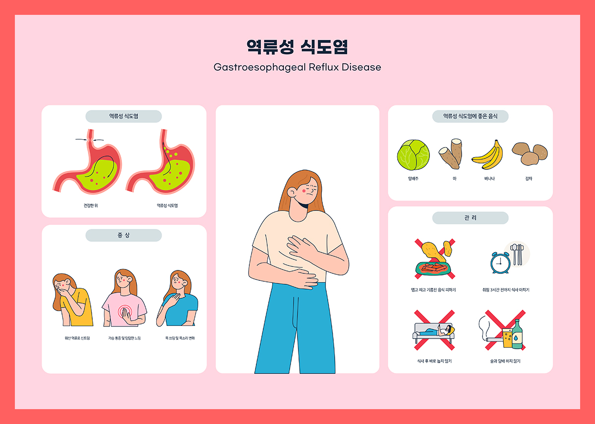 역류성 식도염 목 이물감&amp;#44; 가래가 낀 것처럼 느껴지는 이유