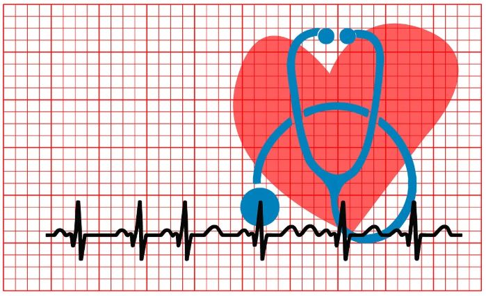 부정맥 ECG 해석법 관련 사진