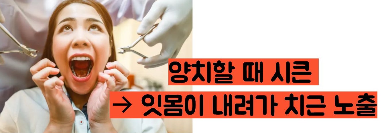이빨이 시린 이유