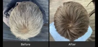 그래비티 카이스트 샴푸 가격 비용 장단점_7