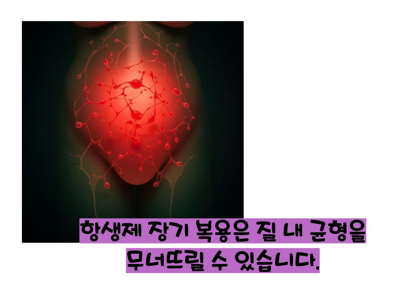 칸디다 질염 원인