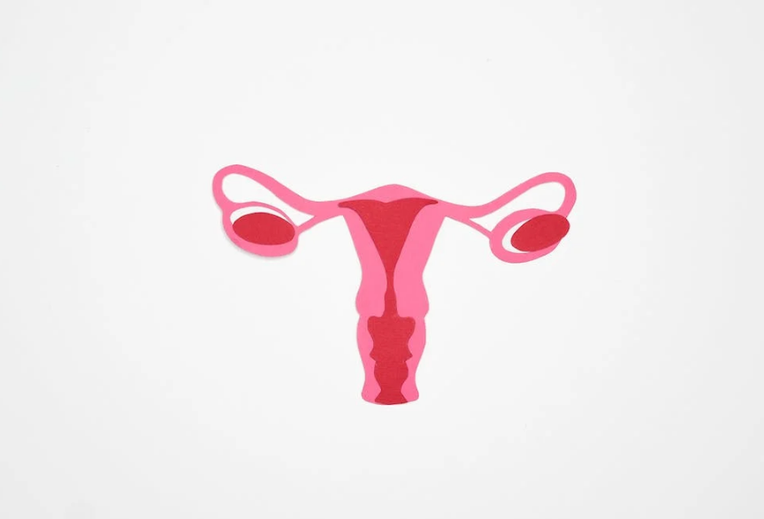 난소다낭증-여성질환