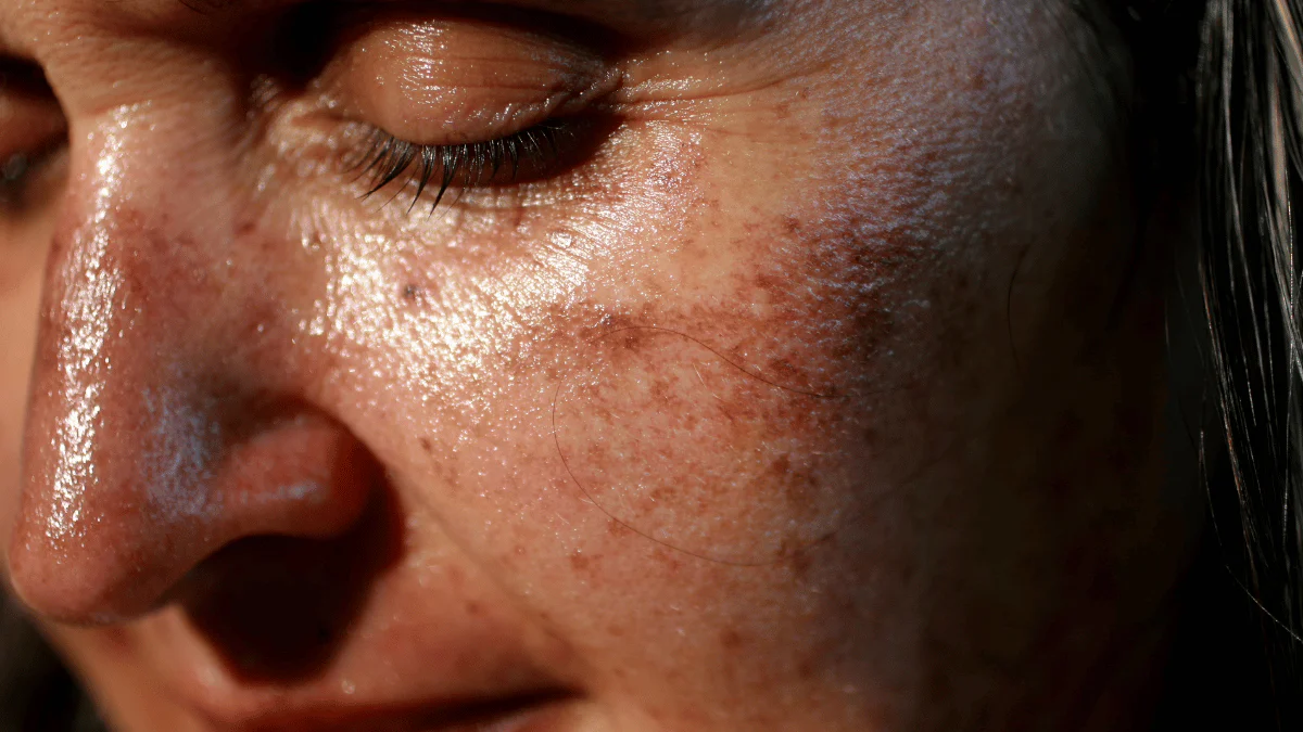 자외선이 피부에 미치는 영향과 자외선 차단제