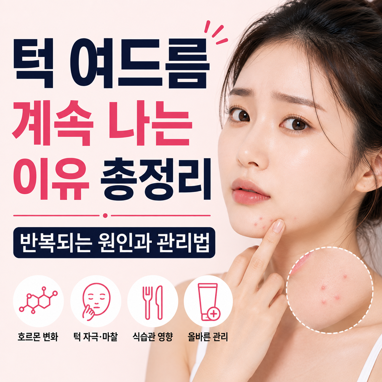 턱 여드름 계속 나는 이유