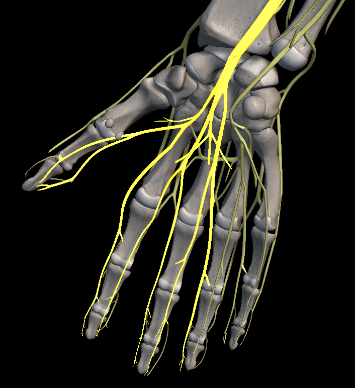 손목터널 증후군