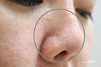 남자 얼굴 피지 제거 화장품 꿀템_13