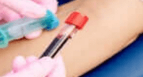 고지혈증증상혈액검사