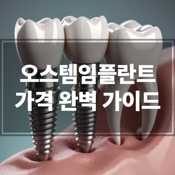 오스템임플란트 가격 완벽 가이드
