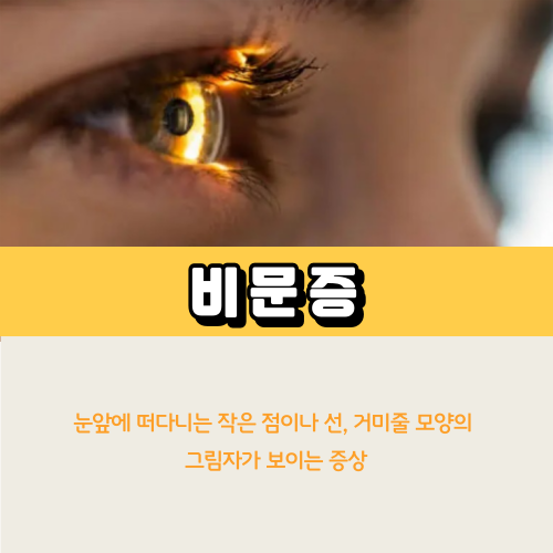 비문증