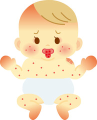 가와사키병 증상 합병증 진단 치료