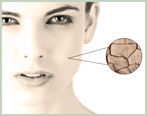 세라티크 세라마이드 효능