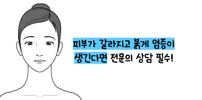 피부 건선 증상