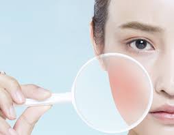 얼굴이 붉어지는 증상