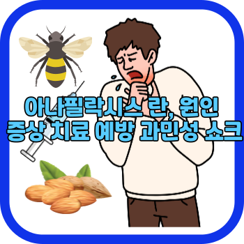 아나필락시스 란, 원인 증상 치료 예방 과민성 쇼크