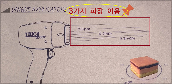 티타늄리프팅- 3가지파장