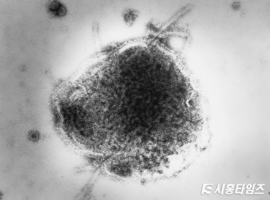 RSV 감염증 치료방법