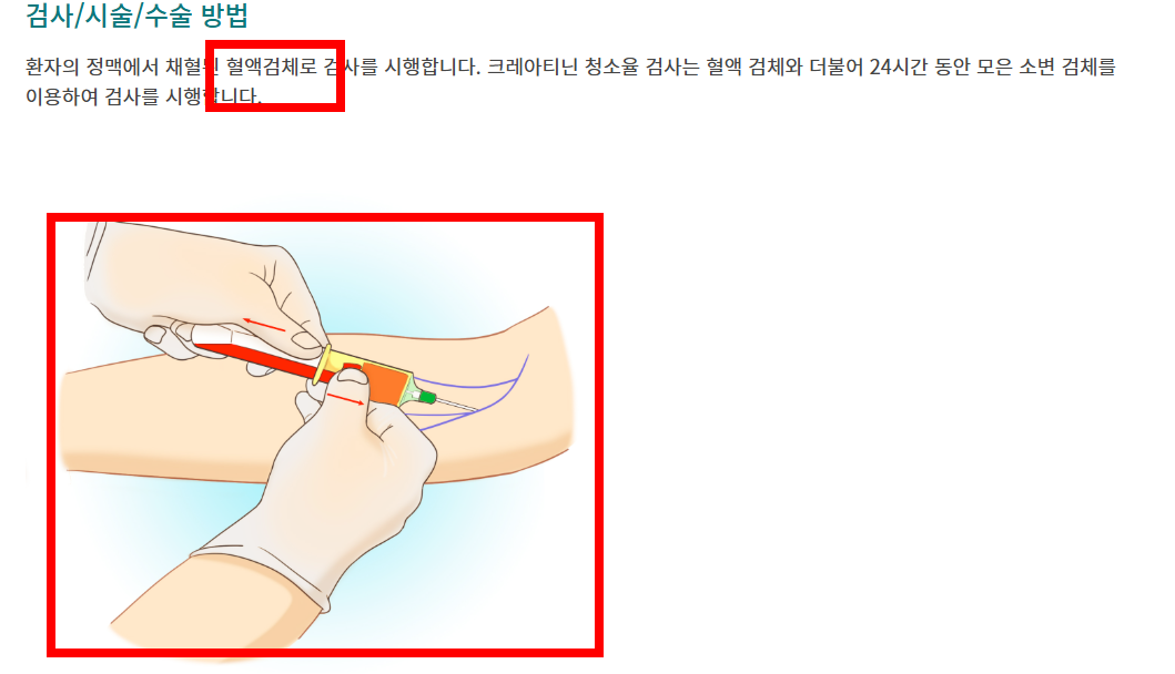 신장 검사방법 알아보기
