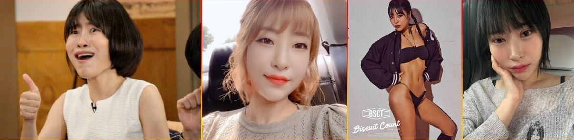 이세영 성형