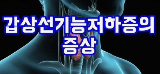 갑상선 기능 저하증 증상