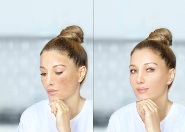 운동 후 안색 변화